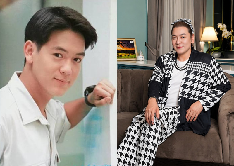 “โก้ ธีรศักดิ์” เปิดประสบการณ์โปรแกรม PCL+CMC ที่ Rassapoom Clinic โดย นพ.รัสมิ์ภูมิ ยกพยุงโครงสร้างใบหน้า ถ่ายทอดลุคที่ได้แรงบันดาลใจจากยุค 90